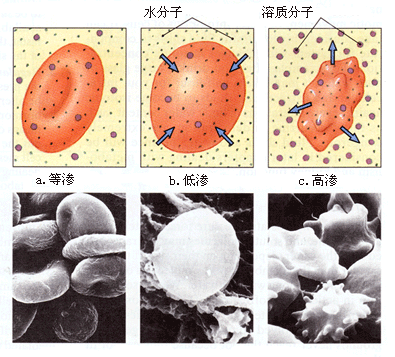 地中海贫血