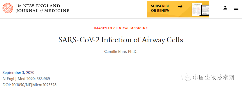 NEJM发布新冠病毒入侵人体时的高清写真！