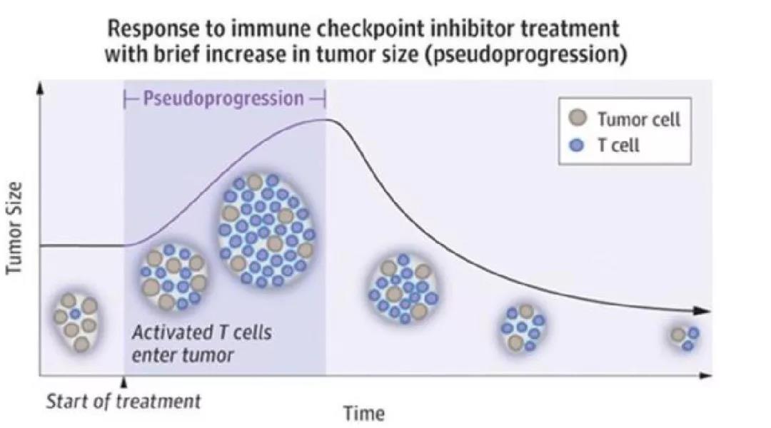 干货！Vv实战经验谈“PD1免疫治疗中的假性进展”