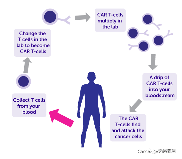 93%的完全缓解患者未复发 CAR-T疗法再添一员猛将 征伐血液肿瘤