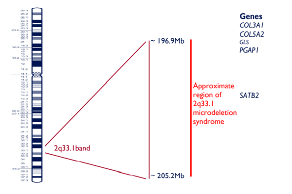 2q33.1微缺失综合征