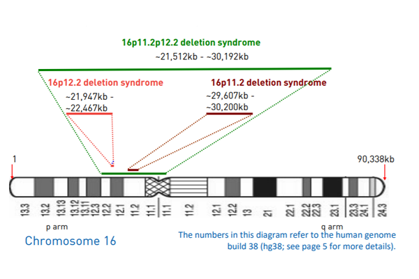 16p11.2-12.2微缺失综合征