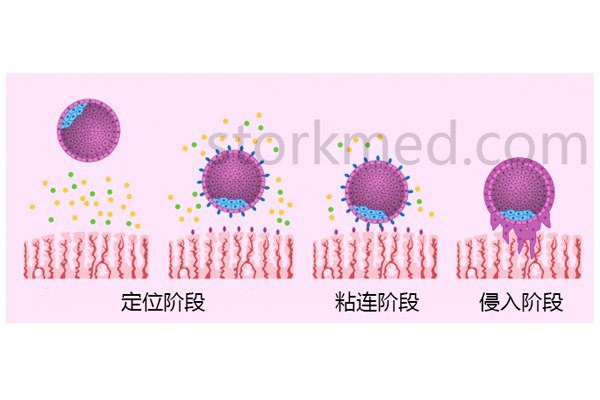 着床示意图分解