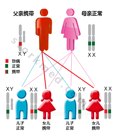 x连锁显性遗传实例